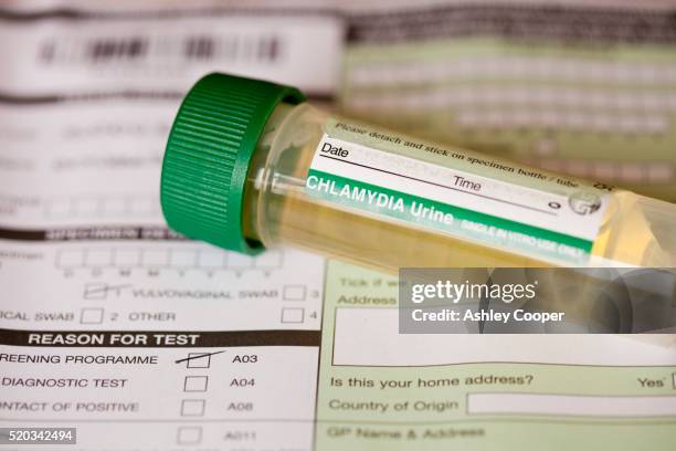 chlamydia self testing kit - chlamydia stock pictures, royalty-free photos & images