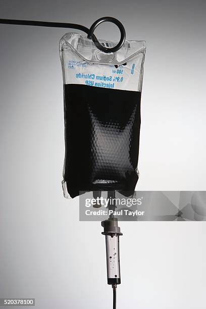 iv with dark liquid - blood bag stock pictures, royalty-free photos & images