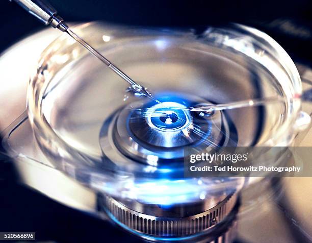 invitro fertilization - microscope photos et images de collection