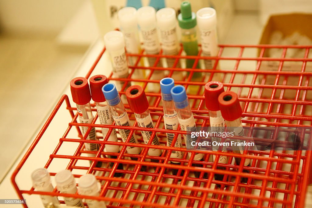 Vials of Blood for Testing at Hospital St. Louis