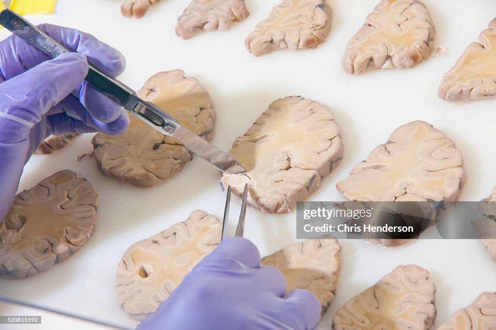 Human brain tissue.