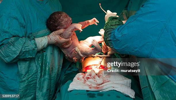 cesarean - caesarean section stock pictures, royalty-free photos & images