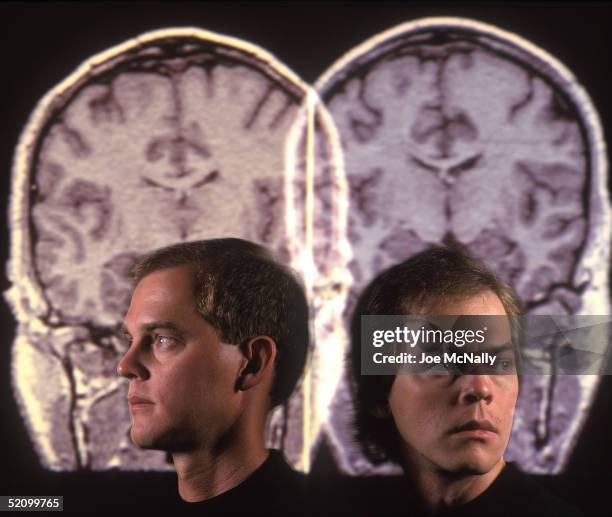 David Elmore and his identical twin brother Steven Elmore pose before their brain scans in 1995 in the U.S. Doctors at the National Institute of...