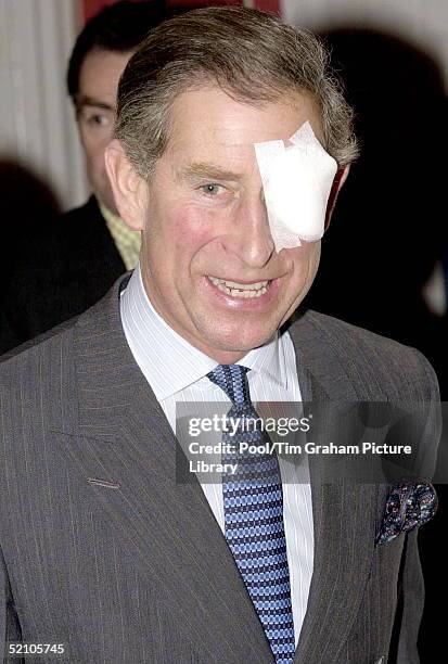 Prince Charles, Wearing An Eye Patch Because Of An Accident In His Garden, Visiting A Home Run By The Entertainment Artistes' Benevolent Fund -...