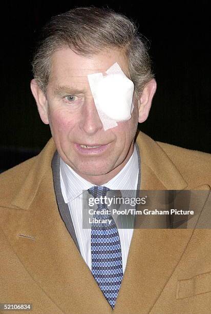 Prince Charles With An Eye Patch After An Accident While Gardening At His Home.