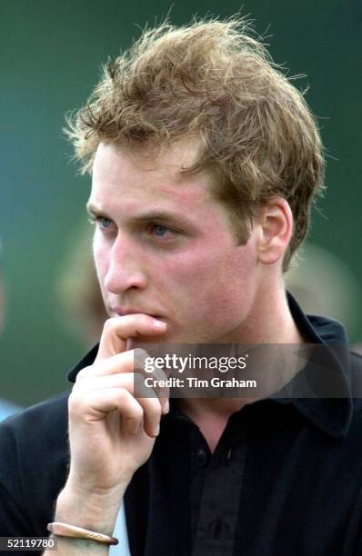 Prince William At A Polo Match At The Beaufort Polo Club. The Scar From An Accident Years Ago Is Clearly Visible.