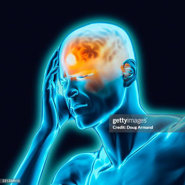 Ilustraciones de Dolor De Cabeza - Getty Images Ilustraciones de Dolor De Cabeza - Getty Images