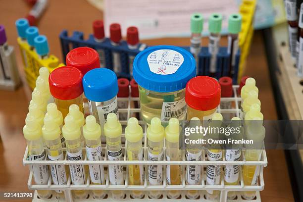 Labo Test 35 Test Labo Stock Photos, High-Res Pictures, and Images - Getty Images