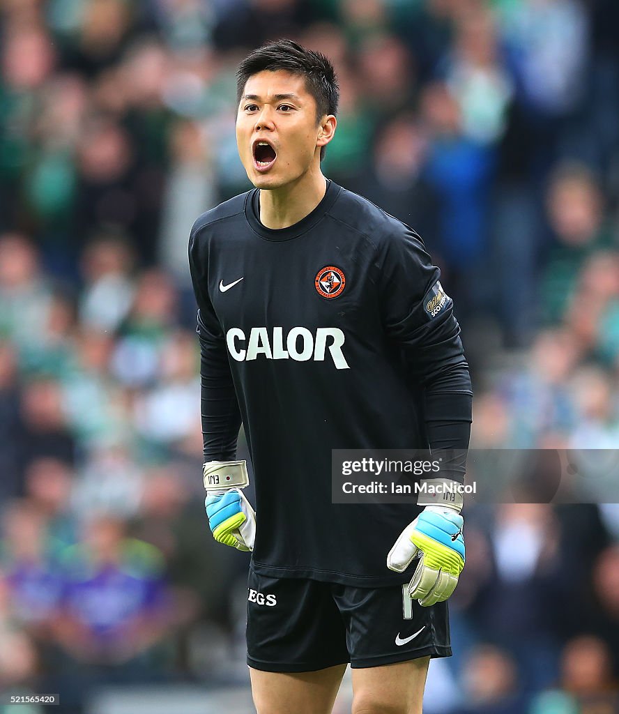 Hibernian v Dundee United - William Hill Scottish Cup Semi Final
