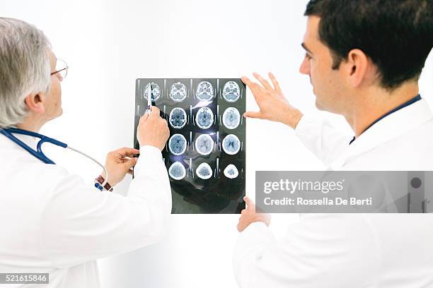 doctors consult over an mri scan of the brain - sclerosis stock pictures, royalty-free photos & images