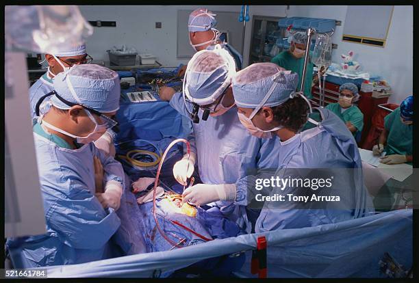 performing open heart surgery - open heart surgery ストックフォトと画像