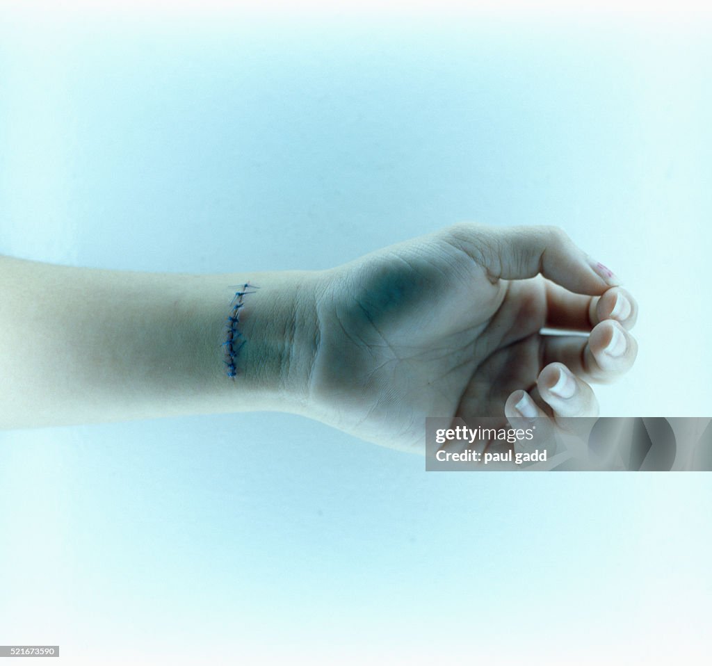 Slit Wrist