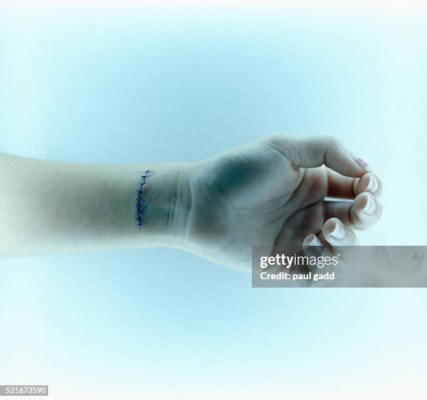 slit wrist - dead person stock pictures, royalty-free photos & images