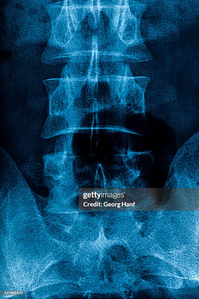 Human lumbar spine