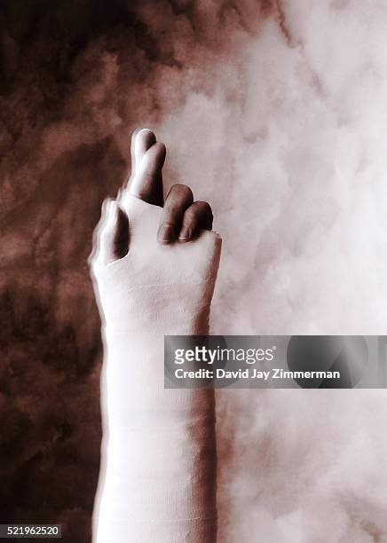 broken arm with fingers-crossed - jay luck stock pictures, royalty-free photos & images