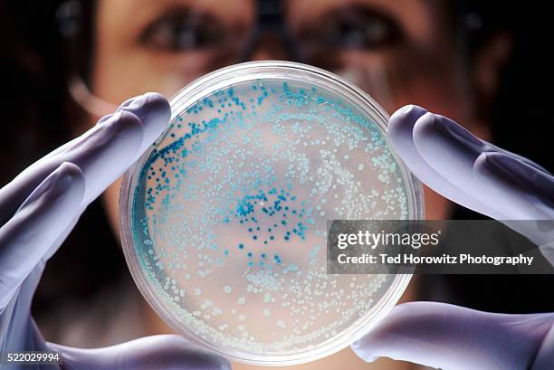 Lab Coli Scope 131 E Coli Under A Microscope Stock Photos, High-Res Pictures, and ...