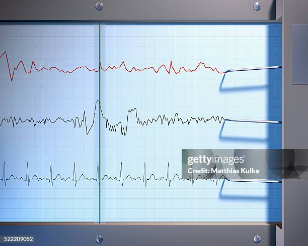 electrocardiogram - heartbeat foto e immagini stock