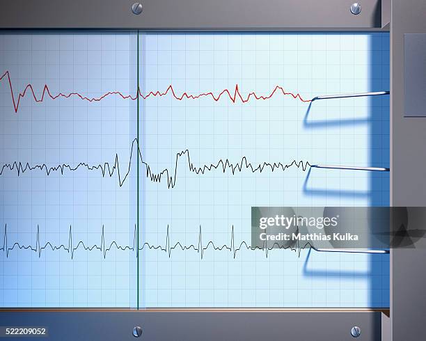 electrocardiogram - pulse trace stock pictures, royalty-free photos & images