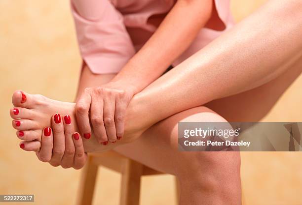 woman with gout - female feet stockfoto's en -beelden