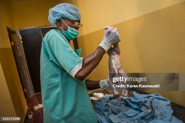 Hard Birth Midwife Africa Baby Photos and Premium High Res Pictures - Getty Images