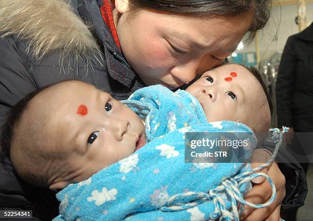 The mother of Siamese twin boys abandoned three days after their birth is reunited with her babies at the Hefei City Children's Hospital, in central...