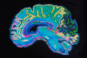 MRI Image Brain On Black Background