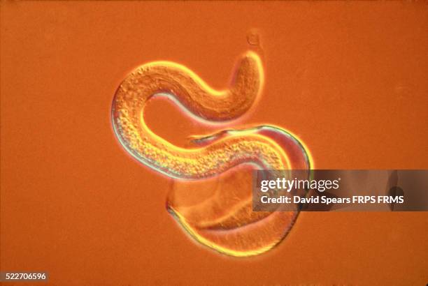 intestinal roundworm - parasit stock-fotos und bilder