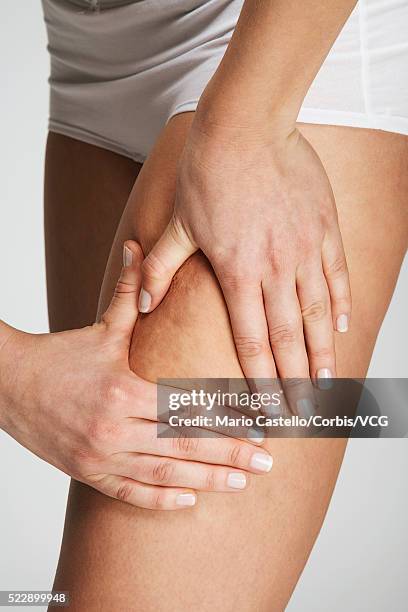 woman worrying about cellulite on her thighs - cellulite stock pictures, royalty-free photos & images
