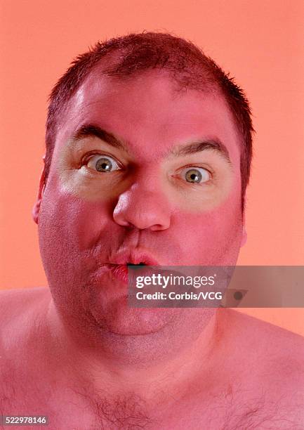 man with raccoon face from sunburn - fat man tanning stock pictures, royalty-free photos & images