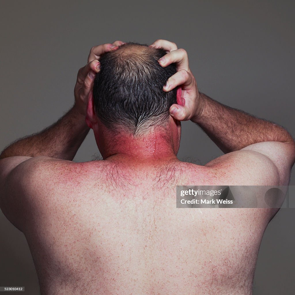 Man with hands on his head