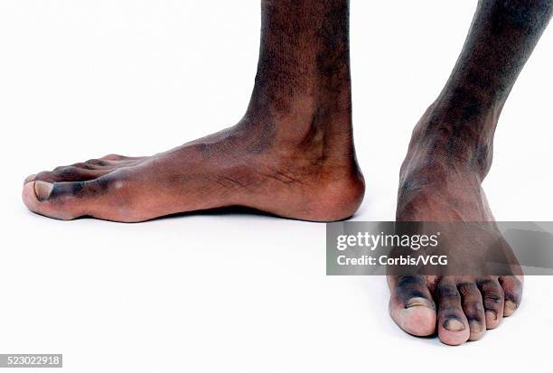 Black Guys Feet Photos and Premium High Res Pictures - Getty Images