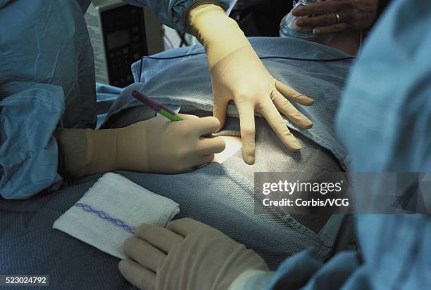 Room Incision 114 Operating Room Drawing Stock Photos, High-Res Pictures, and Images ...