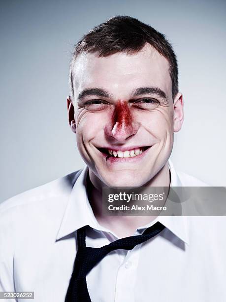 studio portrait of businessman with bruised face - cardenal lesión física fotografías e imágenes de stock