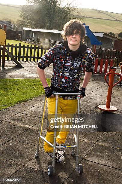 disabled emo teenage boy using walking frame - teenager cerebral palsy stock pictures, royalty-free photos & images