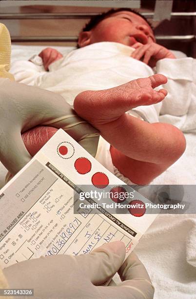 blood test for newborn - piede umano foto e immagini stock