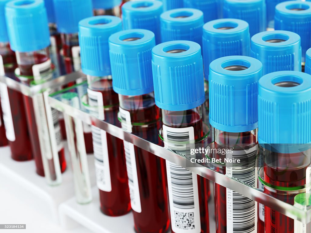 Blood test tubes. Samples in a rack.