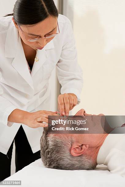 man getting acupuncture - acupuncture elderly stock pictures, royalty-free photos & images