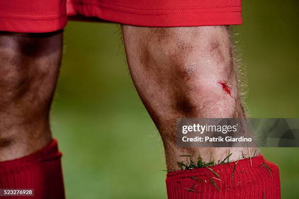 injured soccer player - wunde stock-fotos und bilder