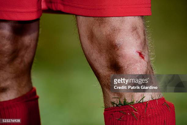 injured soccer player - soccer injury stock pictures, royalty-free photos & images