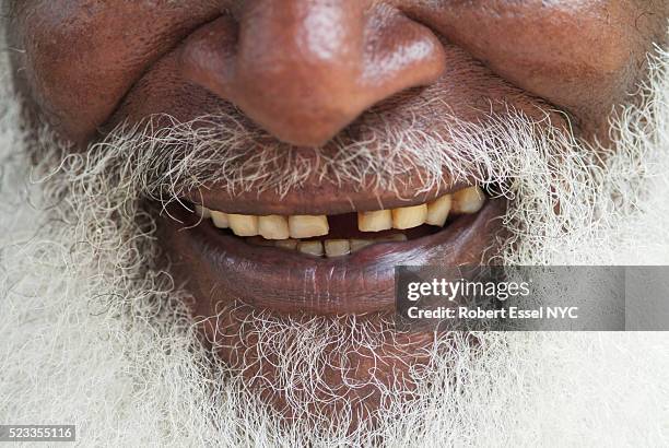 senior man's beard and mouth - rotten teeth from not brushing 個照片及圖片檔