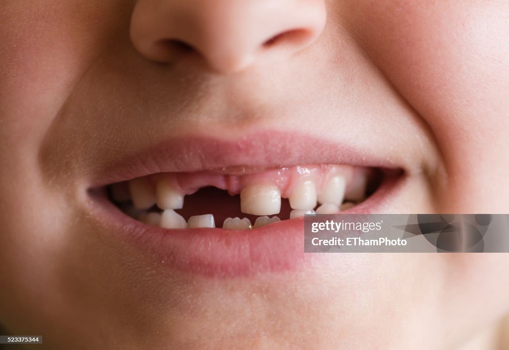 Tooth Space
