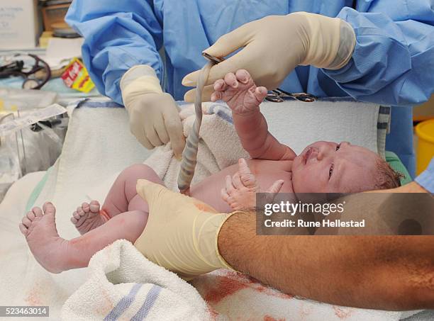 preparing to cut umbilical cord of newborn baby - umbilical cord 個照片及圖片檔