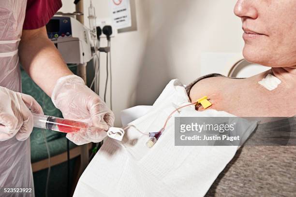 nurse flushing central line before administering chemotherapy treatment - chemo stock pictures, royalty-free photos & images