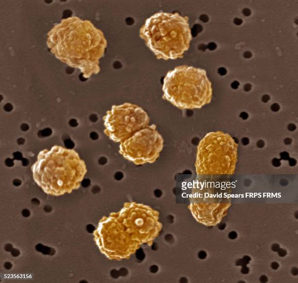 bacteria, staphylococcus aureus with antibiotic - estafilococo fotografías e imágenes de stock
