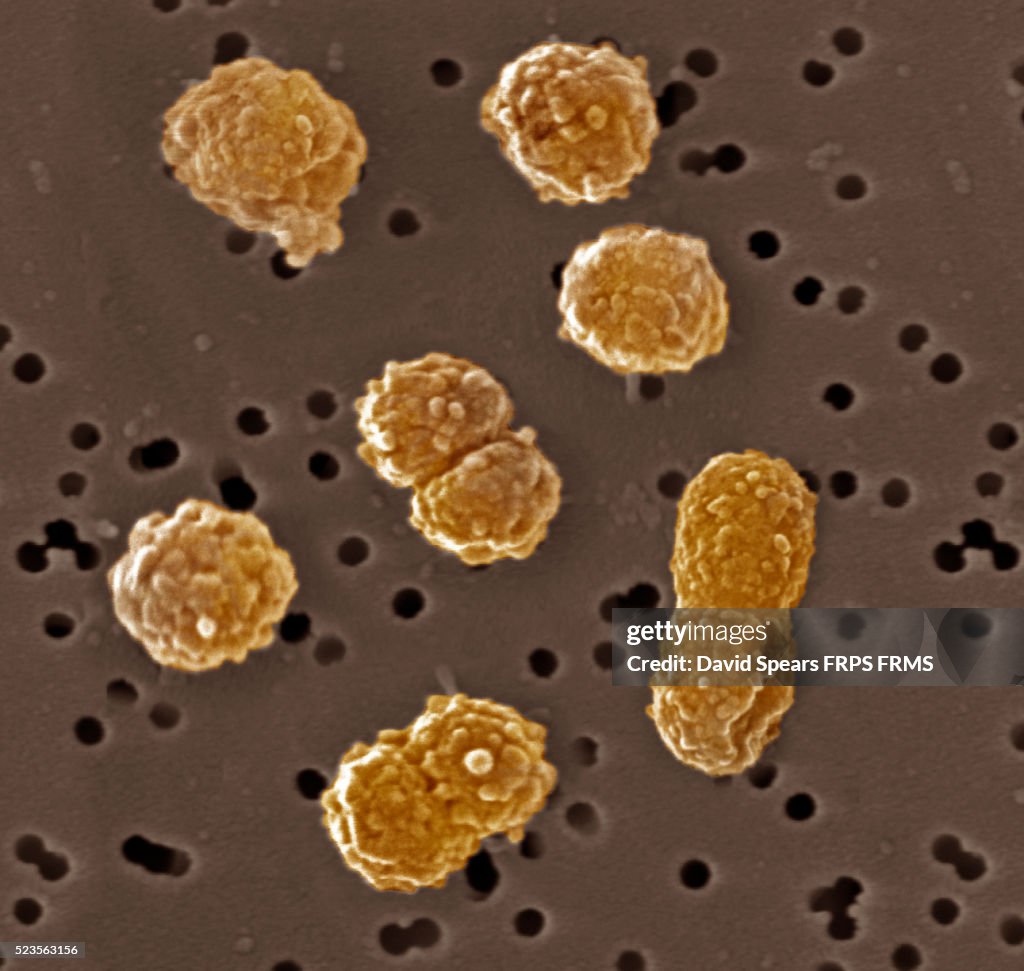 Bacteria, Staphylococcus aureus with antibiotic