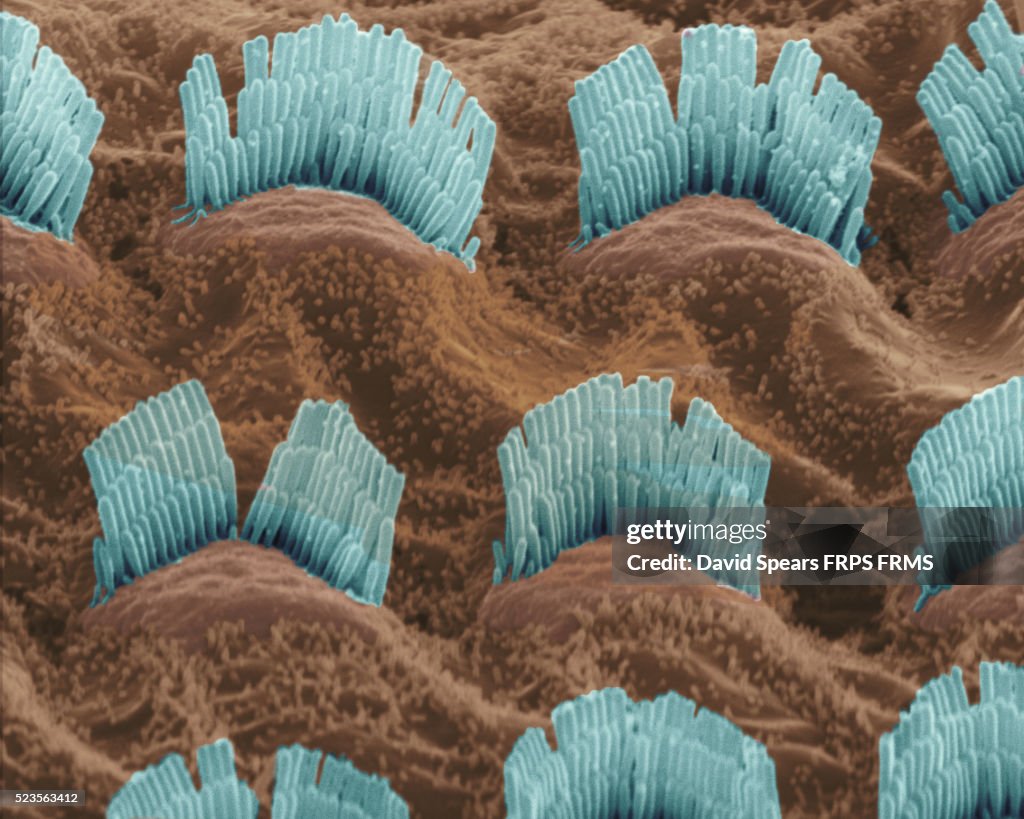 Hair cells in cochlea