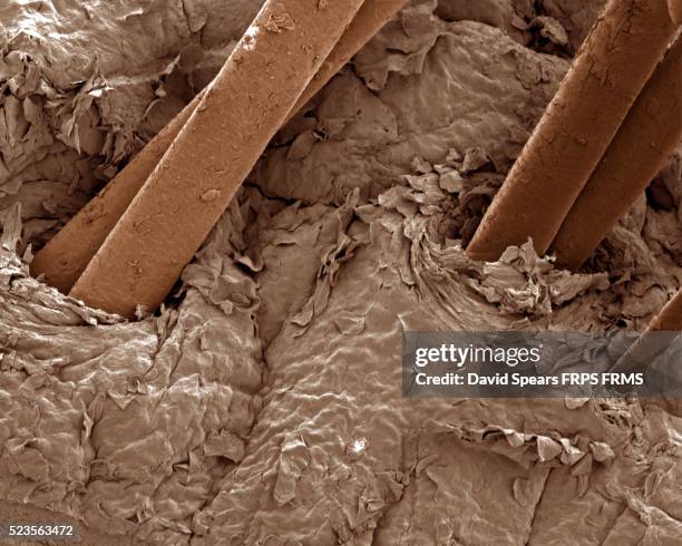 Demodex Infection In Humans 36 Demodex Mites Stock Photos, High-Res Pictures, and Images - Getty Images