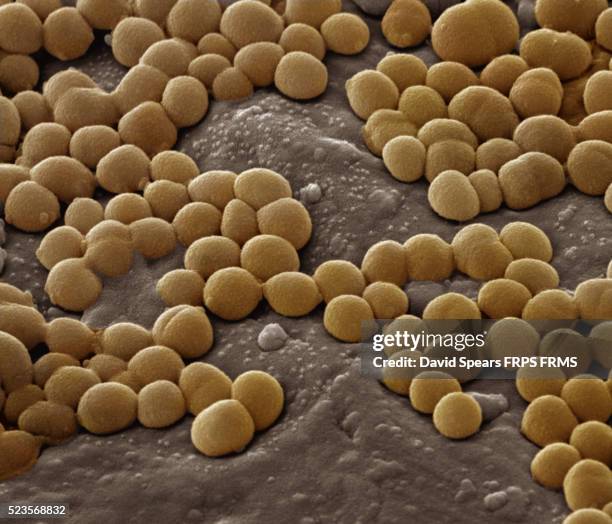 staphylococcus aureus - メチシリン耐性黄色ブドウ球菌 ストックフォトと画像