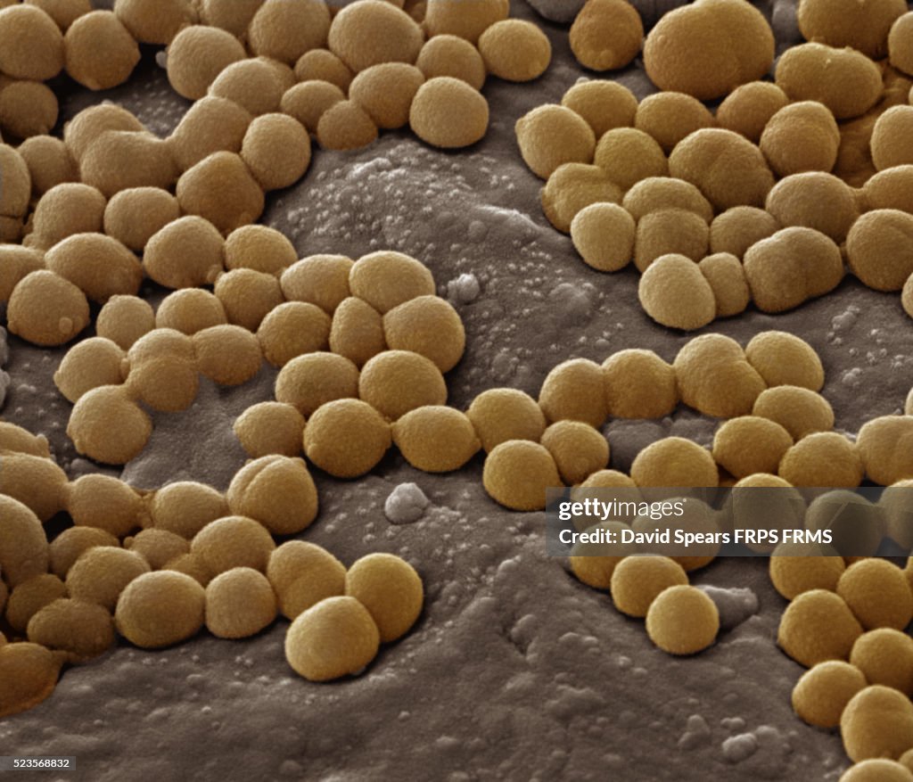 Staphylococcus aureus