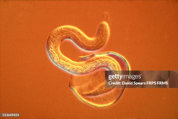 intestinal roundworm - parasitic ストックフォトと画像